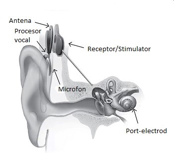 Compartiment audiologie - Sectie O.R.L.